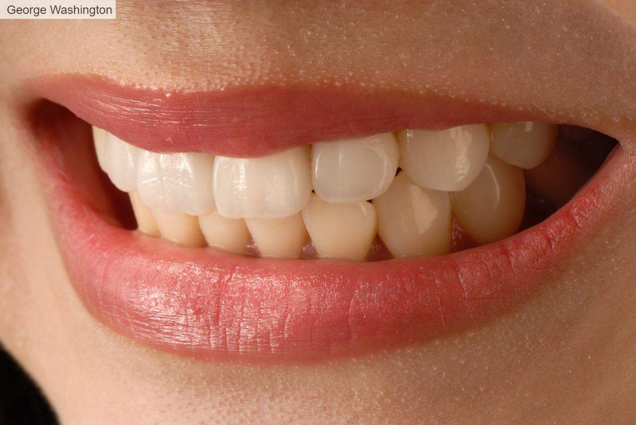 Las mejores carillas dentales en Valencia